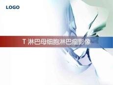T淋巴母细胞淋巴瘤影像