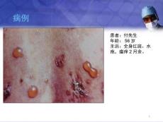 优质课件大疱性类天疱疮.ppt