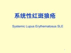 系统性红斑狼疮课件