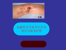 化脓性关节炎课件