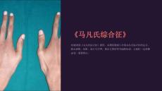 《马凡氏综合征》课件