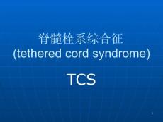 脊髓栓系综合征（课件