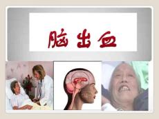 脑出血-课件