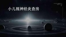 小儿视神经炎查房