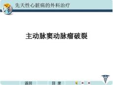 主动脉窦瘤破裂.ppt