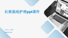 红斑狼疮护理ppt课件