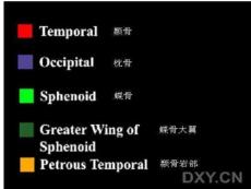 颅底影像解剖