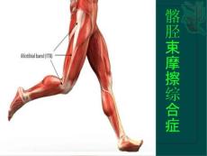 髂胫束摩擦综合症课件
