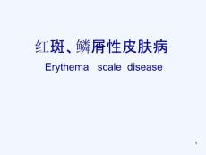 红斑鳞屑性皮肤病课件