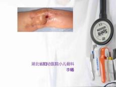 化脓性关节炎查房课件