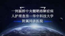 一例脑桥中央髓鞘溶解症病人护理查房—华中科技大学附属同济医院