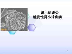 肾小球肾炎继发性肾小球疾病课件