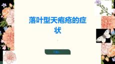 落叶型天疱疮落叶型天疱疮的症状有哪些