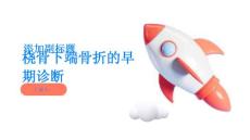 桡骨下端骨折如何进行早期诊断