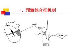 预激综合征教程课件.ppt