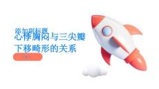 心悸胸闷与三尖瓣下移畸形有关了解二者之间的关系