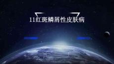 11红斑鳞屑性皮肤病M