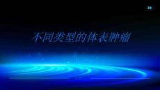 体表肿瘤了解不同类型的体表肿瘤