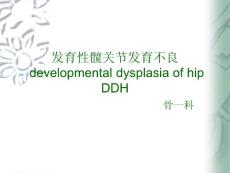 发育性髋关节发育不良-课件