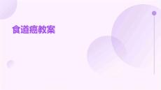 《食道癌教》课件