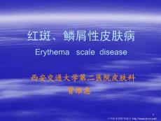 红斑鳞屑性皮肤病-