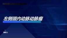 左侧颈内动脉动脉瘤