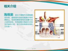 颈动脉海绵窦瘘的护理ppt课件.ppt
