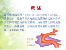 颈动脉海绵窦瘘的护理教学查房PPT课件.ppt
