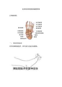趾骨骨折康复锻炼健康图谱