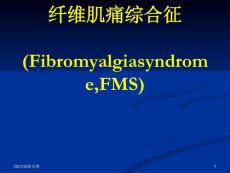 纤维肌痛综合征1
