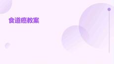 《食道癌教》课件