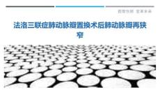 法洛三联症肺动脉瓣置换术后肺动脉瓣再狭窄