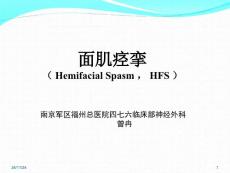 面肌痉挛