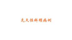 先天性斜颈病例