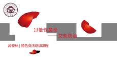 过敏性鼻炎课件