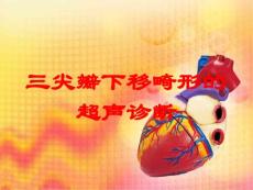 三尖瓣下移畸形的超声诊断培训课件