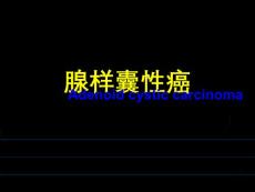 腺样囊性癌