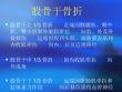 下肢脊柱骨折