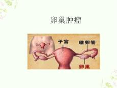 卵巢肿瘤的护理