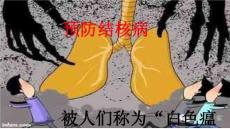 预防结核病