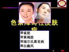 色素障碍性皮肤病