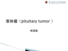 垂体瘤影像诊断