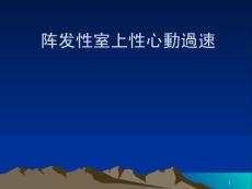 阵发性室上性心动过速