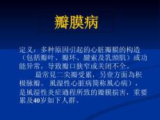 二尖瓣狭窄