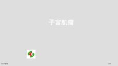 子宫肌瘤讲解