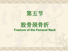 股骨颈骨折