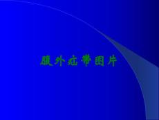 腹外疝带图片
