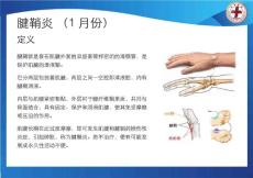 健康宣教——腱鞘炎