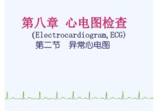 异常心电图心肌缺血心肌梗死