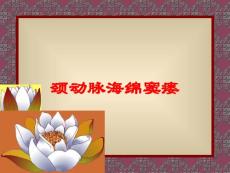 医学医疗-颈动脉海绵窦瘘培训课件